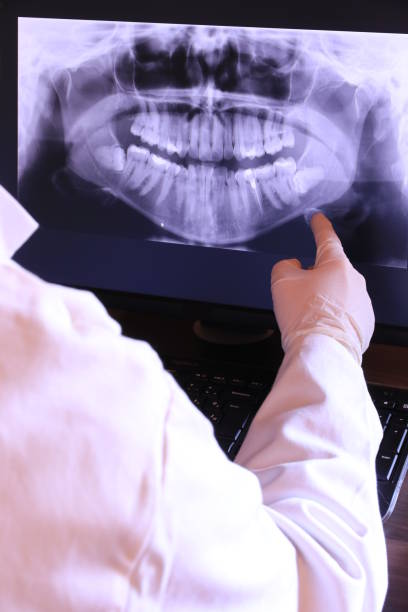 Best Emergency Tooth Extraction  in Mapleton, ND